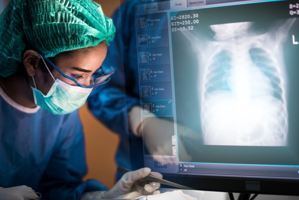Pie Medical Imaging